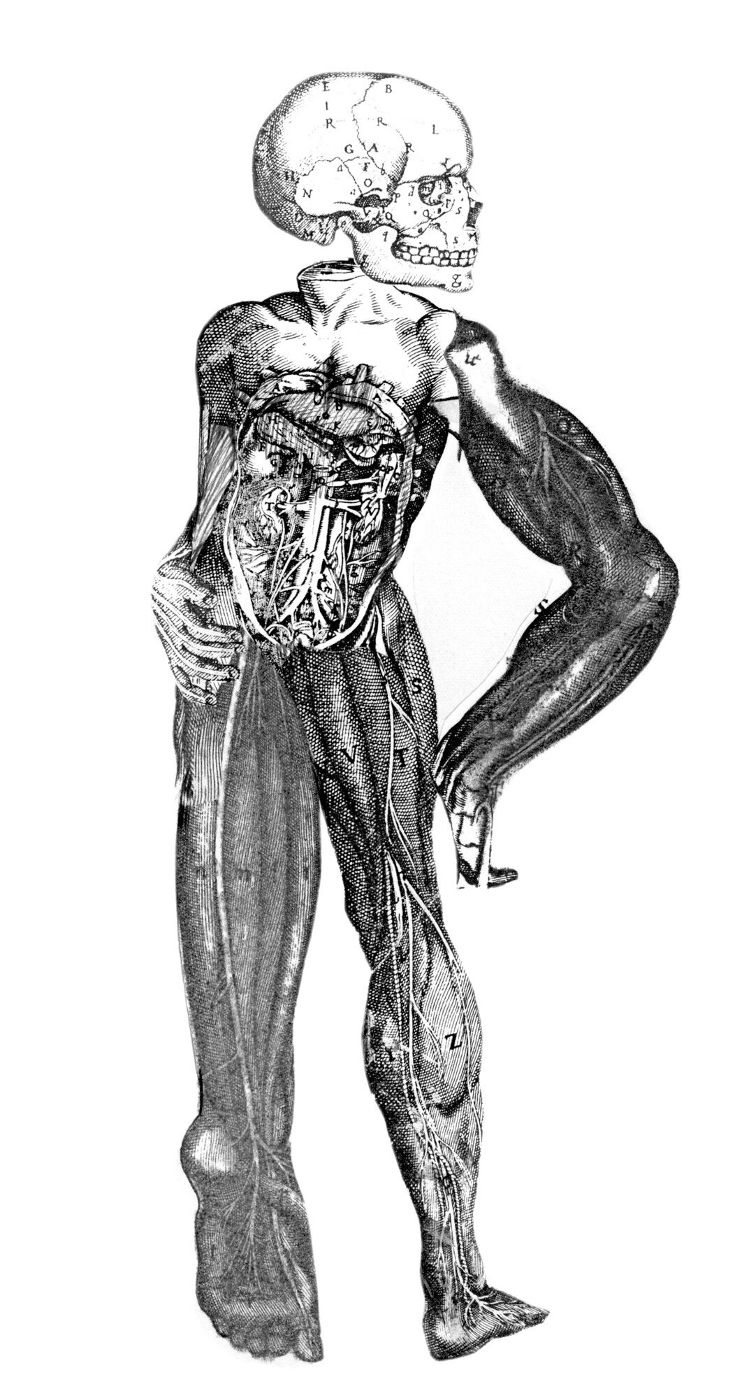 Raztelešenje (Masaker)